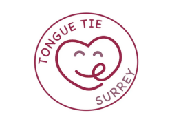 TongueTieSurrey